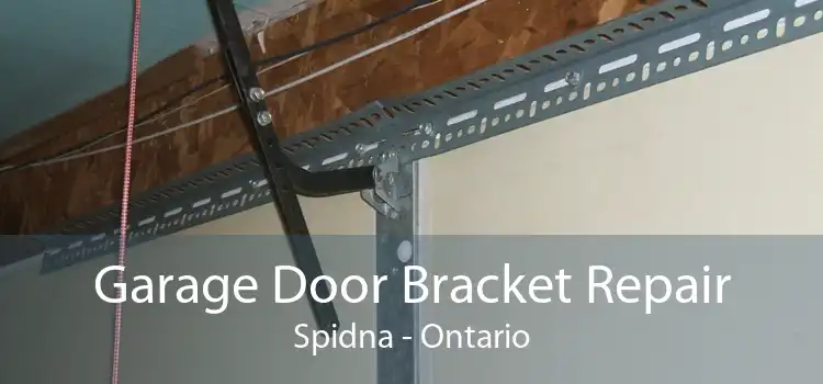 Garage Door Bracket Repair Spidna - Ontario
